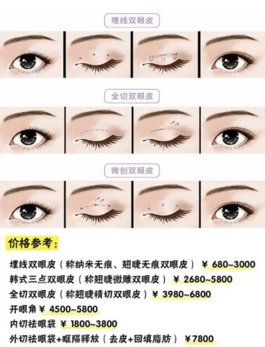 做双眼皮的价格一般是多少?跟拆盲盒似的,全看好多因素“凑热闹”