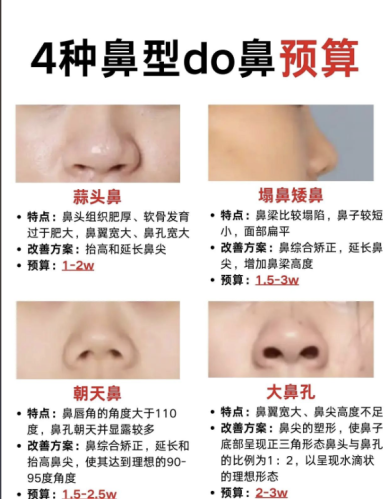 威海中心医院隆鼻价格：不同材料价格天差地别