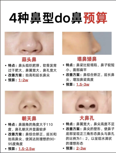 杭州第一人民医院钱江新城院区做鼻子多少钱?看价格,更要看安全性和效果