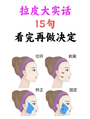 拉皮手术的副作用和危害:那些“见不得光”的风险