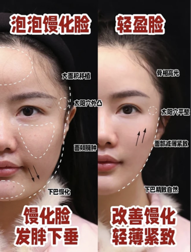 馒化修复是什么?检测、溶解、紧致一条龙服务
