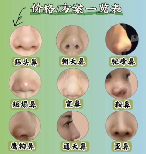 泰州人民医院隆鼻价格是多少?建议先到医院面诊再决定