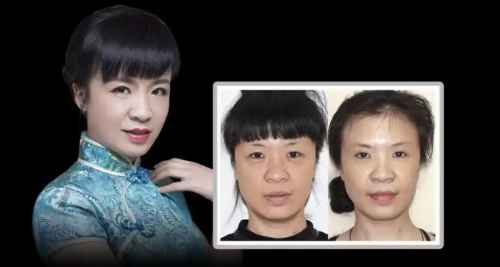 锦州中心医院隆鼻怎么样?多样的技术合理的价格
