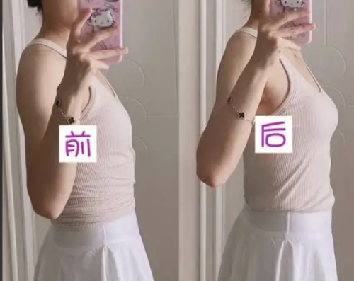 杭州第一人民医院隆胸多少钱?扒一扒这家医院隆胸的真实费用