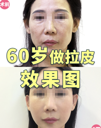 截屏2025-07-26 16.35.28.png