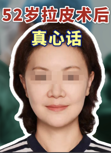 宜宾第二人民医院拉皮除皱多少钱?专业团队+硬核设备,口碑直接拉满!