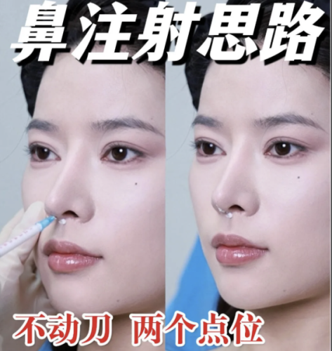 做注射隆鼻可以顺便打鼻基底和眉骨吗?需结合个人面部基础来评估