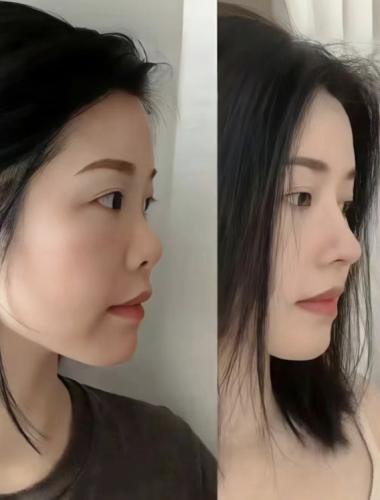 武汉中西医结合医院隆鼻怎么样？医疗质量、安全管理严格，让人放心