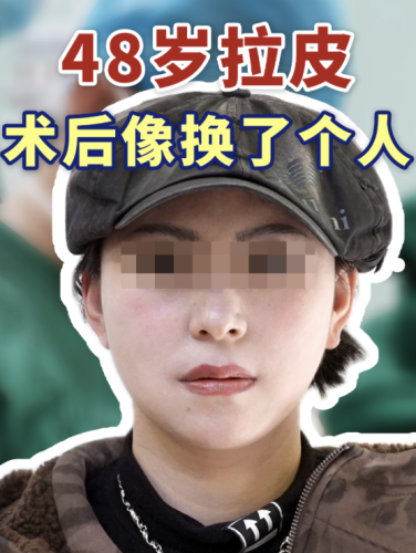 南昌大学第二附属医院拉皮除皱多少钱？硬核的配置友好的价格