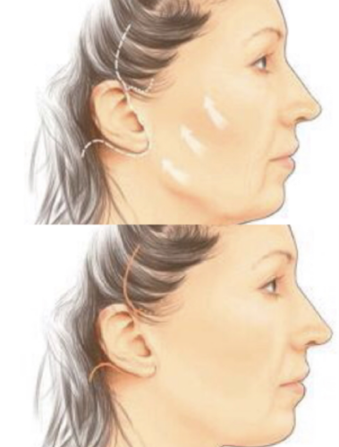 截屏2025-07-28 22.46.25.png