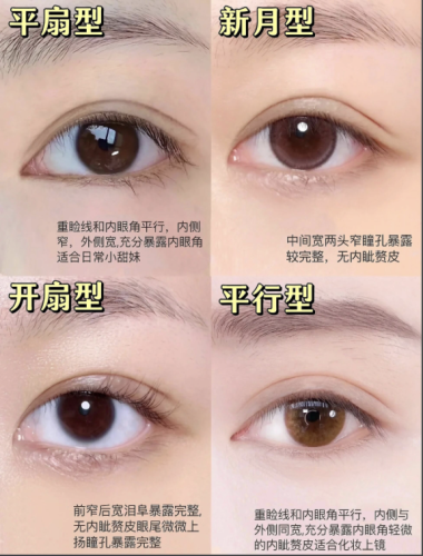 无锡第九人民医院割双眼皮多少钱?每种方式的价格各有差异