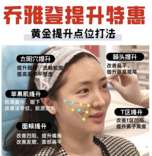 乔雅登注射提升打法:火出圈的变美秘籍!