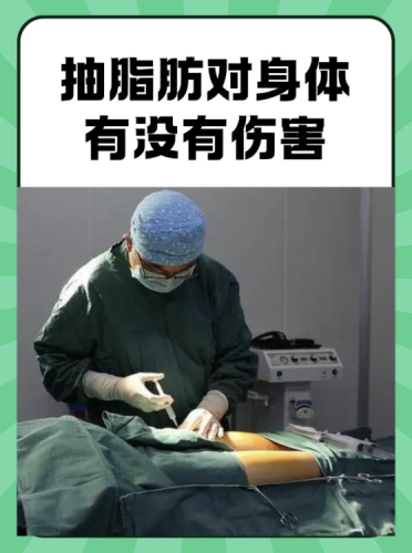 广州医科大学附属第二医院抽脂好吗?价格在什么范围?