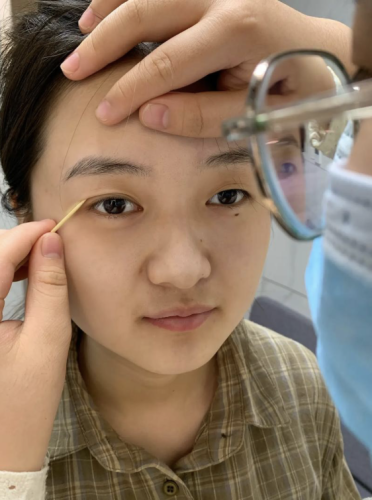 广东药科大学附属第一医院割双眼皮多少钱?个人眼睛条件影响价格