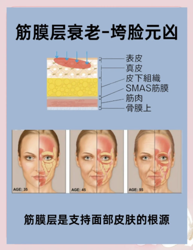 做筋膜提升多久能恢复好？提前到正规医院面诊，了解自身情况后再做决定