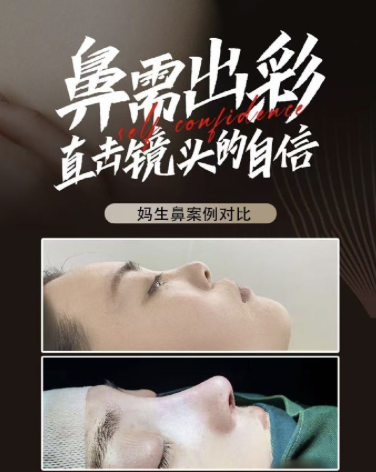 青岛大学附属医院做鼻子多少钱?价格范围较广,从4000元到50000元不等