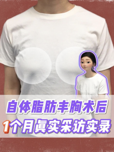 截屏2025-07-31 21.33.30.png