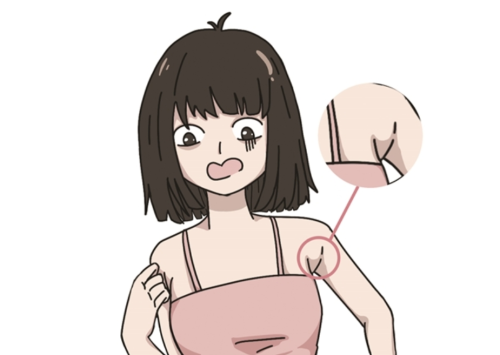 割副乳大概多少钱?从费用到恢复一文读懂