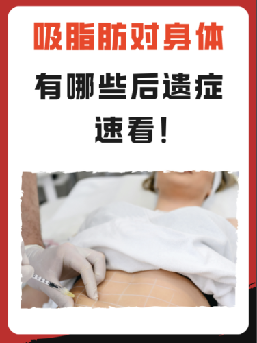 抽脂有什么风险和后遗症？速看，真的不是开玩笑的