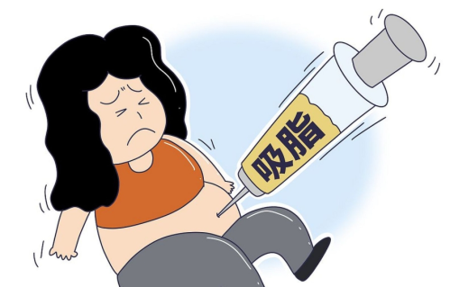 柳州人民医院吸脂多少钱?医院整形科技术、挂号全攻略