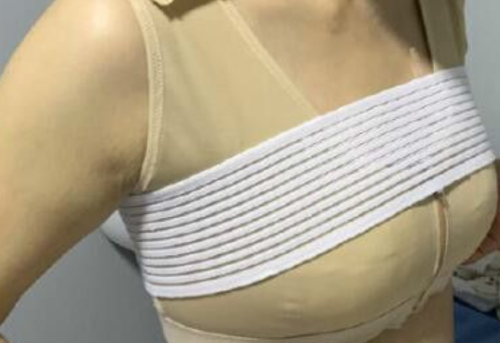 做乳房悬吊术后胸会变小吗?答案比你想的更复杂