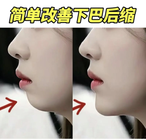 短下巴怎么矫正？支招让你离完美颜值更近一步！