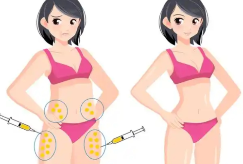哈尔滨瑞丽抽脂价格表，价格合理+术后服务到位，难怪这么火