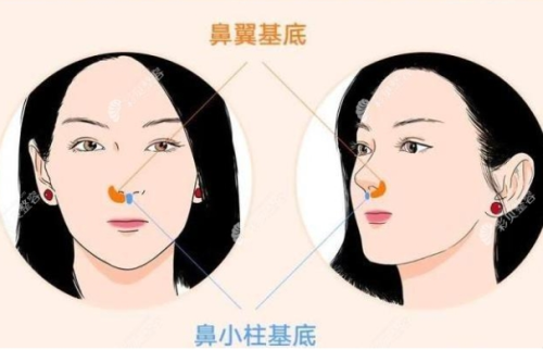 鼻基底是哪个位置？多维科普一次了解这个部位