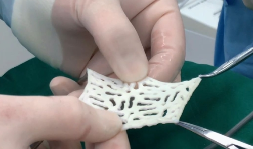 生物补片增粗有效果吗？“从铅笔到马克笔”，一篇告诉你效果有多硬核