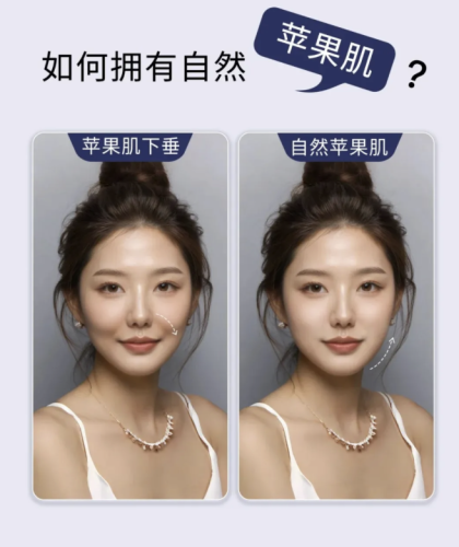 填苹果肌用什么玻尿酸？这份指南带你选对 “膨膨水”