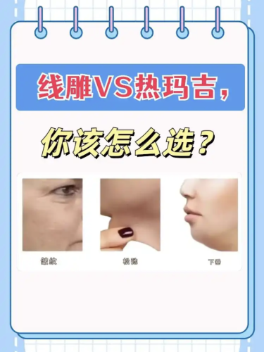 热玛吉和线雕哪个提升效果好？效果 Battle 现场，主打一个一目了然