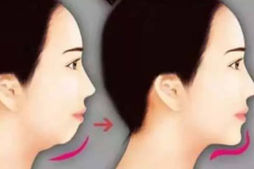 哈尔滨瑞丽脂肪填充好的医生是哪位?技术派的实力与审美派的较量