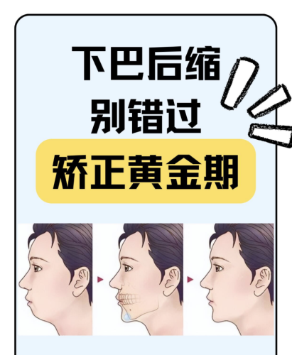 截屏2025-08-14 22.08.09.png