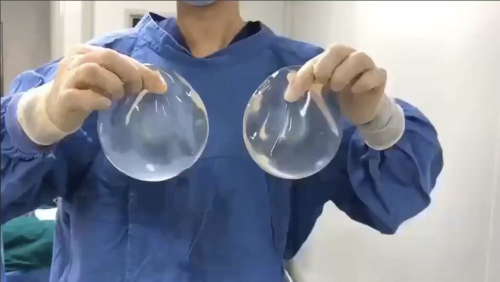 万和假体和威宁假体哪个好？3 组真实案例告诉你，这两款差别能影响 5 年胸型