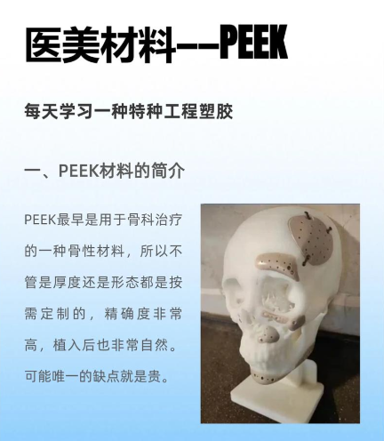 peek假体是什么材料？医美老炮用3个案例+2张表讲透，附避坑指南