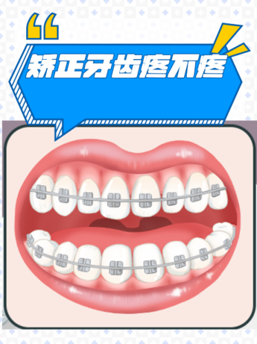 绵阳医博口腔牙齿矫正怎么样?2025真实测评+本地案例,矫正选对不踩坑