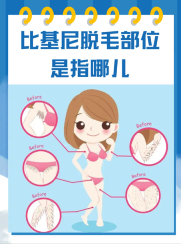 比基尼脱毛是脱哪个区域?2025硬核科普+避坑指南,新手也能精准 get