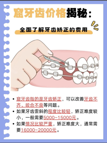 广医二院牙齿正畸多少钱?2025价目表+真实案例全揭秘