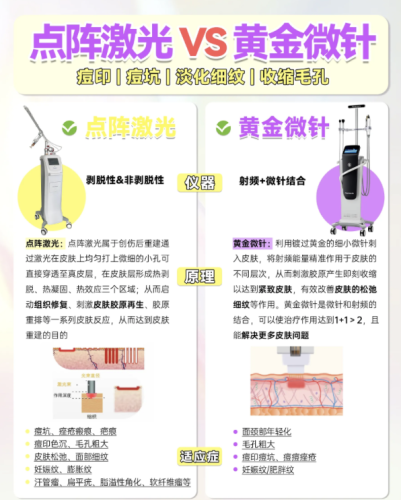 激光除皱和黄金微针除皱哪个好？医生揭秘：3类皱纹选对效果翻2倍