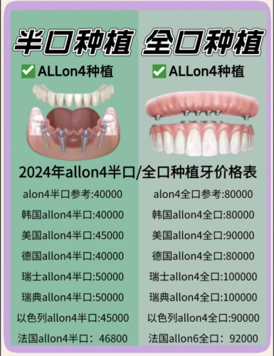 广州德伦口腔牙齿种植价格多少?2025集采后价目表+真实案例揭秘