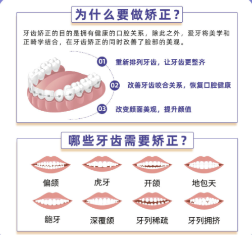 南京市口腔医院矫正牙齿要多少钱？消费明细+挂号技巧一文说透