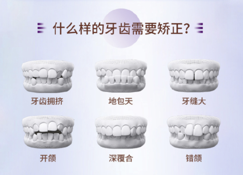 截屏2025-11-28 13.24.51.png