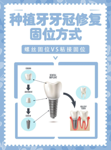 合川种植牙哪家医院好？公立+私立实测攻略，避坑还省钱