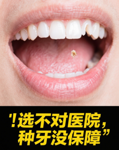 深圳宝安种牙哪家医院好？好医院的核心，是“安全+适配+透明”