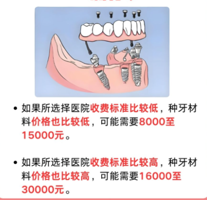 上海青浦区种牙哪家好？参考选院逻辑，可以对号入座