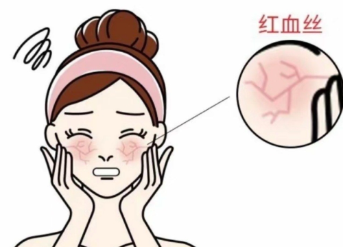 激光祛红血丝效果怎么样？一次带你看清激光对敏感泛红的改善幅度，别再被广告绕晕