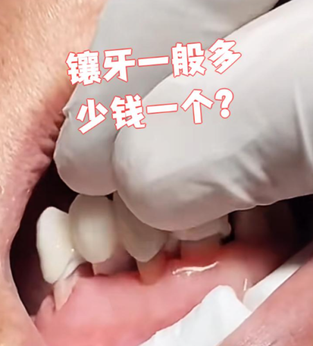 大兴镶牙便宜的医院：6家低价靠谱机构实测，省钱不踩雷的秘诀都在这
