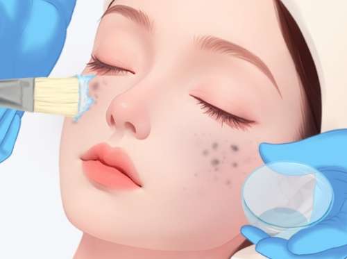 芯丝翠果酸换肤效果怎么样？项目原理+恢复情况速看