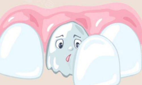 阜阳美欧牙齿贴面怎么样？口碑体验和材料选择先了解